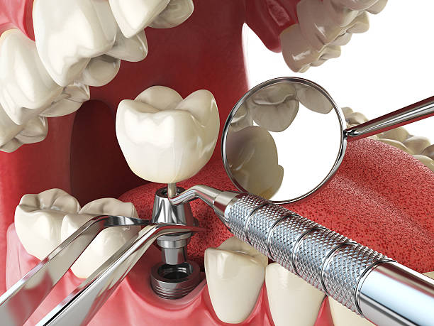 Best Emergency Denture Repair in Pennside, PA
