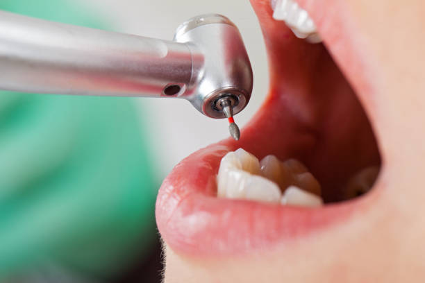 Best Broken or Chipped Tooth Repair in Pennside, PA